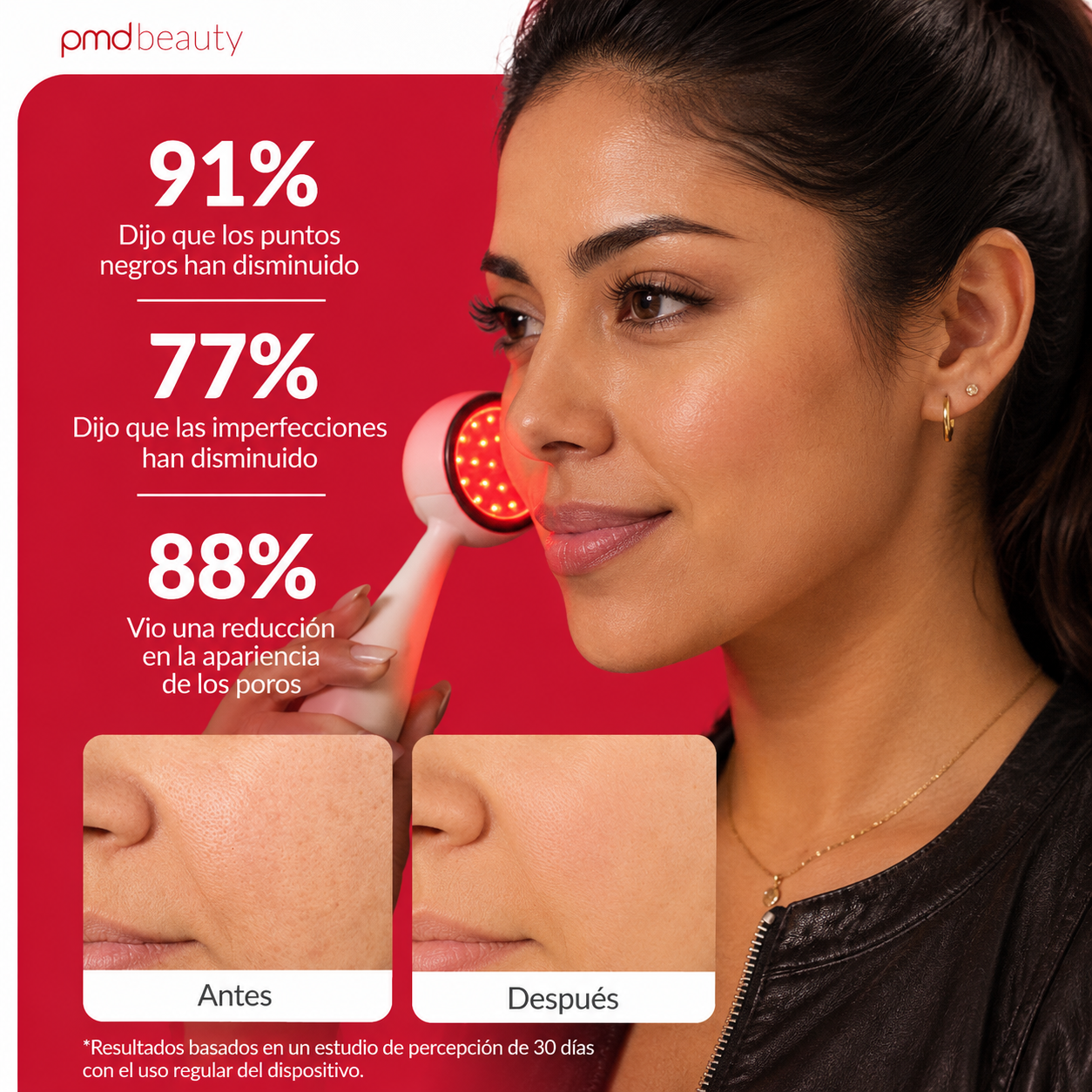 PMD Personal Microderm Clasico Microdermoabrasión en Casa para una Piel Más Suave y Radiante