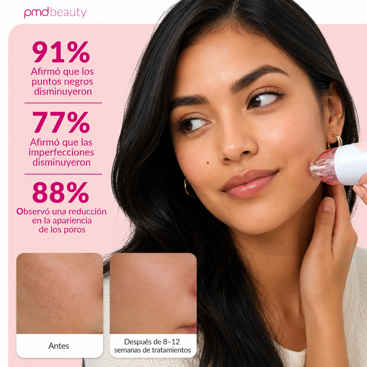 PMD Personal Microderm Clasico Microdermoabrasión en Casa para una Piel Más Suave y Radiante