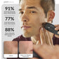 PMD Personal Microderm Elite Pro Microdermoabrasión Profesional para Rostro y Cuerpo