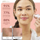 PMD Personal Microderm Elite Pro Microdermoabrasión Profesional para Rostro y Cuerpo