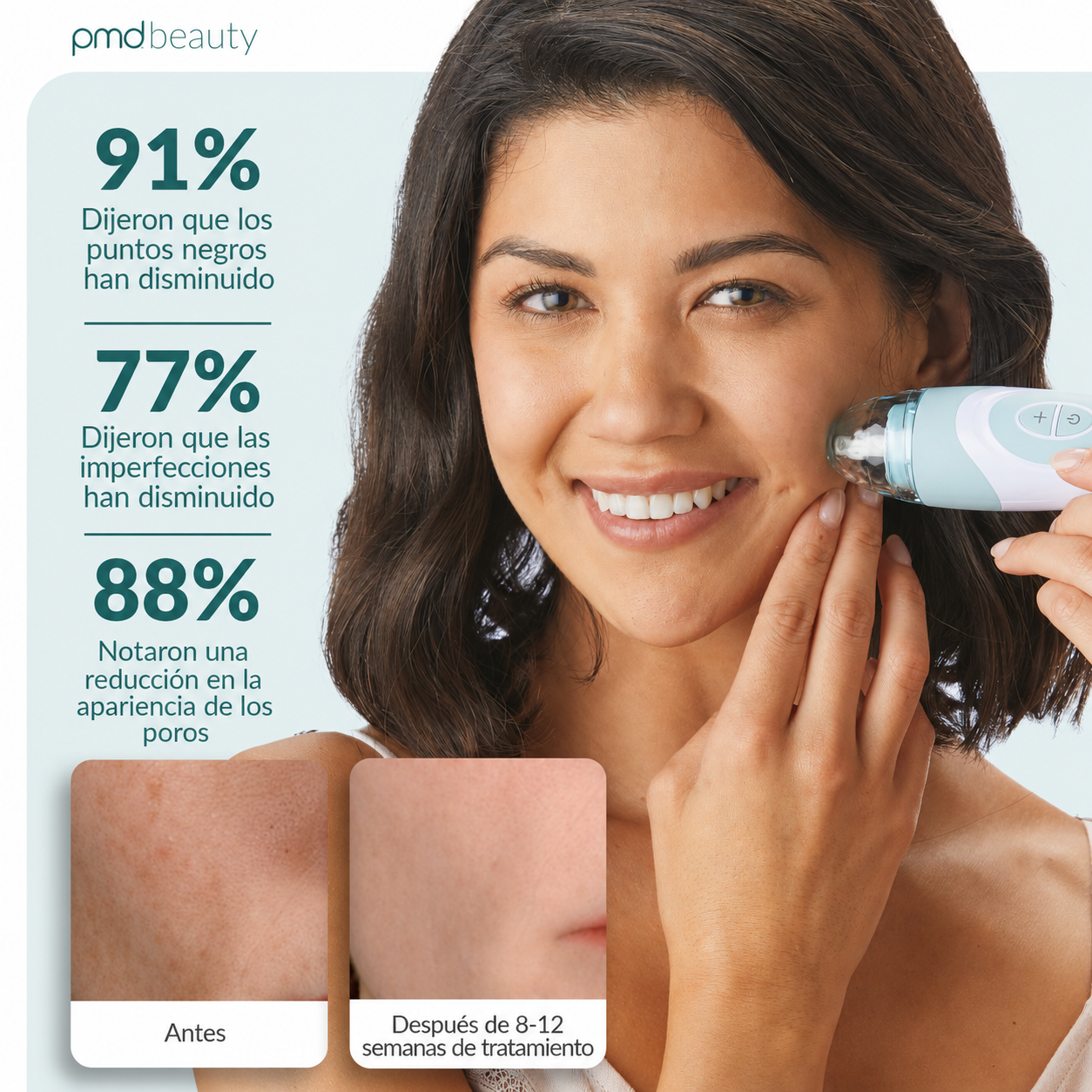 PMD Personal Microderm Elite Pro Microdermoabrasión Profesional para Rostro y Cuerpo