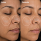 PMD Clean Mini | Cepillo Facial de Silicona para Limpieza Profunda y Rejuvenecimiento Facial