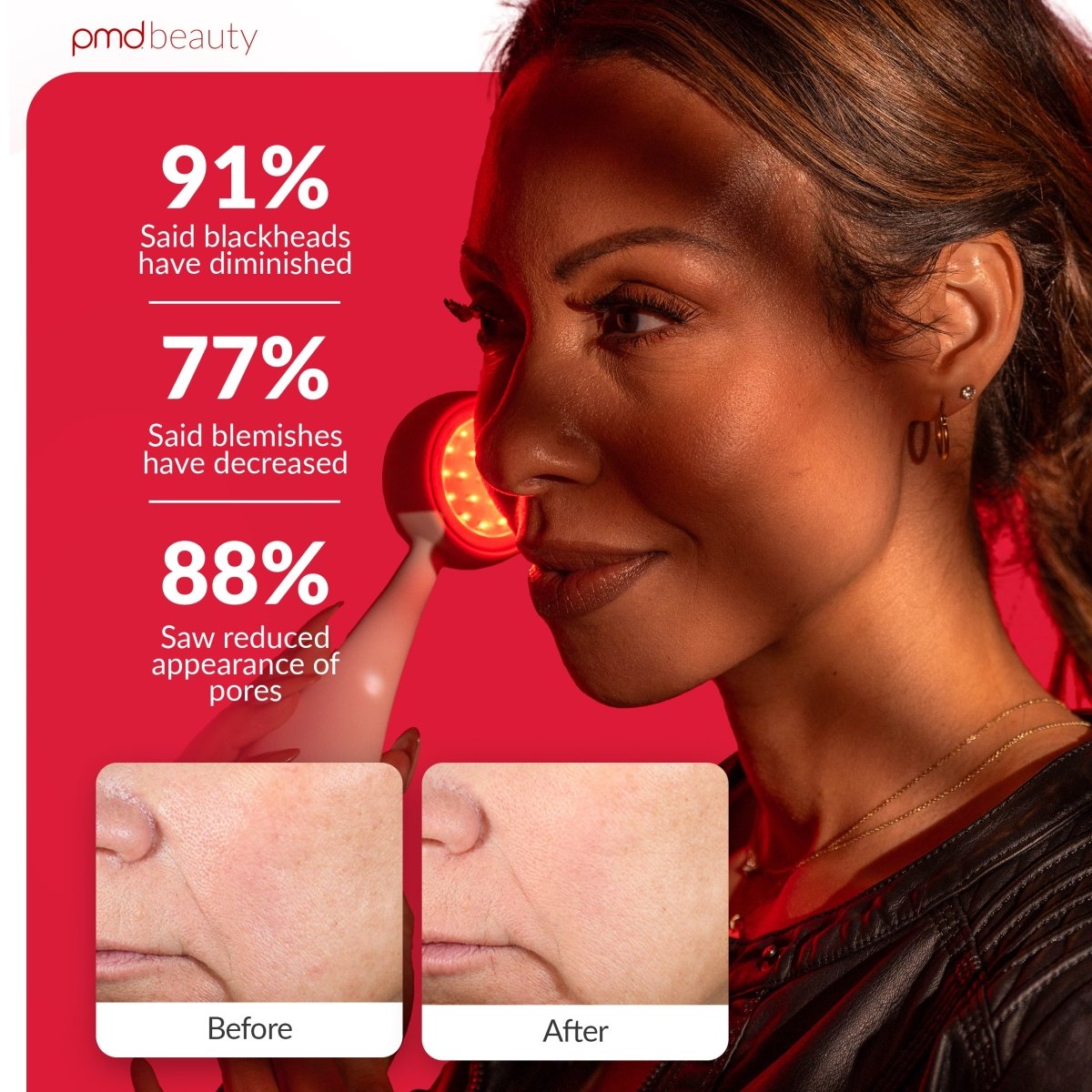 PMD Clean Redvolution | Cepillo Facial con Terapia de Luz Roja LED y Limpieza Profunda
