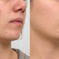 PMD Clean Redvolution Cepillo Facial con Terapia de Luz Roja LED para Limpieza Profunda