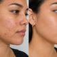 PMD Clean Redvolution Cepillo Facial con Terapia de Luz Roja LED para Limpieza Profunda