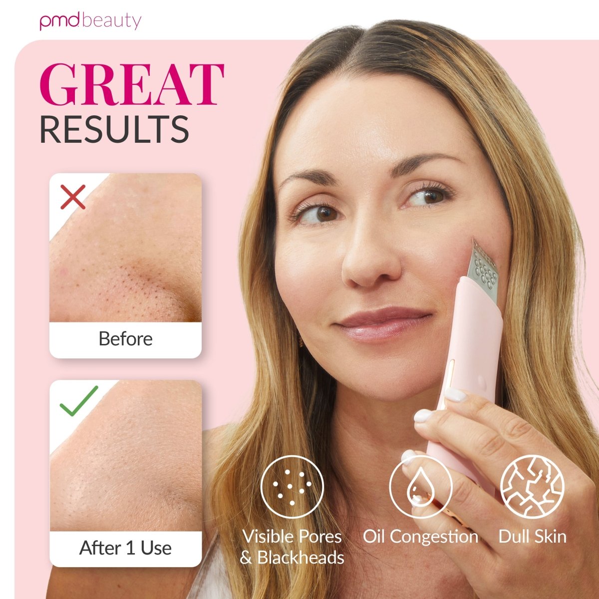 PMD WavePro Dispositivo para Limpieza Profunda de Poros, Eliminación de Puntos Negros y Reafirmación Facial