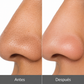 PMD WavePro Dispositivo para Limpieza Profunda de Poros, Eliminación de Puntos Negros y Reafirmación Facial