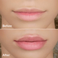 PMD Kiss | Dispositivo para Aumentar el Volumen de los Labios y Reducir Líneas Finas