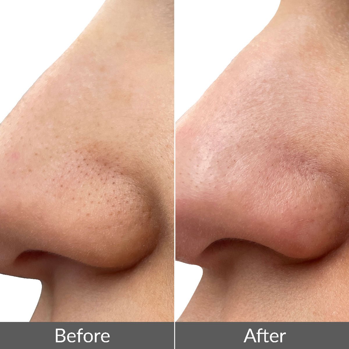 PMD WavePro Dispositivo para Limpieza Profunda de Poros, Eliminación de Puntos Negros y Reafirmación Facial